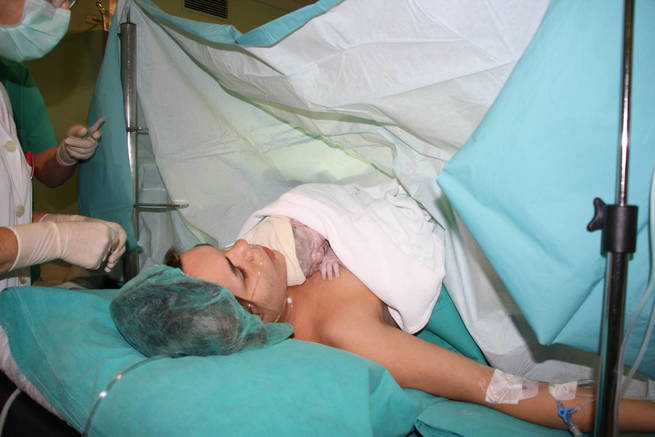 Los servicios de Pediatría, Paritorio y Quirófano elaboran un protocolo para el contacto inmediato piel con piel tras la cesárea en el Hospital de Cuenca