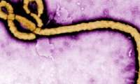 imagen de SATSE reclama medidas urgentes para garantizar la seguridad de los profesionales en el caso Ébola
