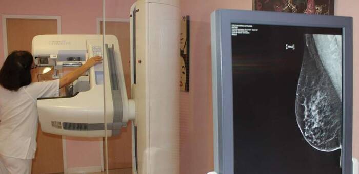 Gobierno regional confirma que todas las mujeres del cribado de cáncer de mama en Talavera están notificadas