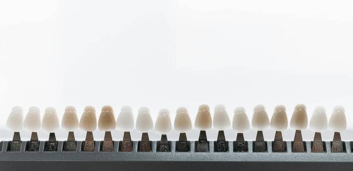 Microcarillas: Consigue una sonrisa perfecta