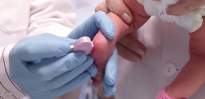 Castilla-La Mancha amplía a 34 las enfermedades detectadas en la "prueba del talón" de recién nacidos